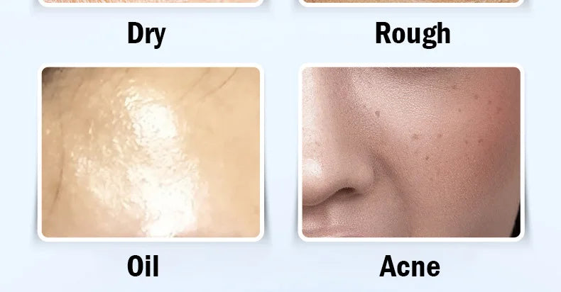 Fruit Moisturizing Facial Mask 5pcs skincare Whitenting Hydrating Anti-aging Facial Masks Face Masks